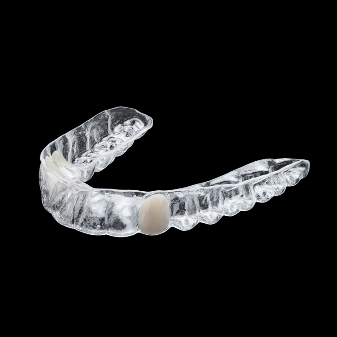 EssixRetainersWithTooth