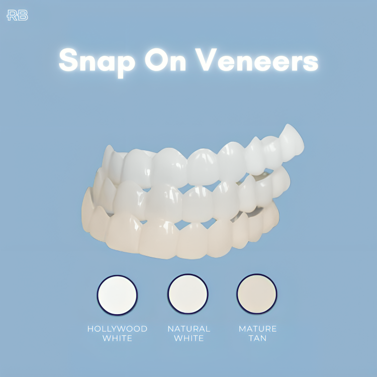 Snap On Veneers