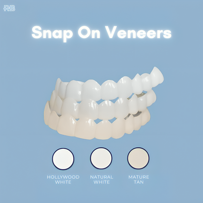Snap On Veneers