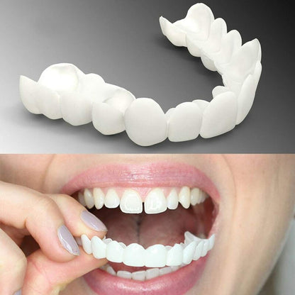 Snap On Veneers